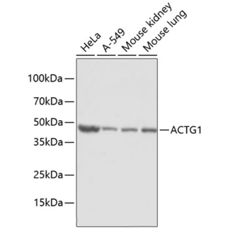 Western Blot - Anti-ACTG1 Antibody (A2631) - Antibodies.com