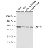Western Blot - Anti-ACTG1 Antibody (A2631) - Antibodies.com