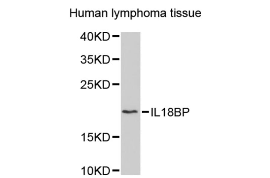 Western Blot - Anti-IL18BP Antibody (A2650) - Antibodies.com