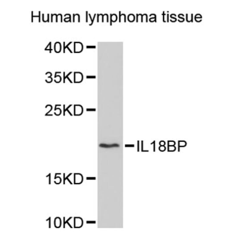Western Blot - Anti-IL18BP Antibody (A2650) - Antibodies.com