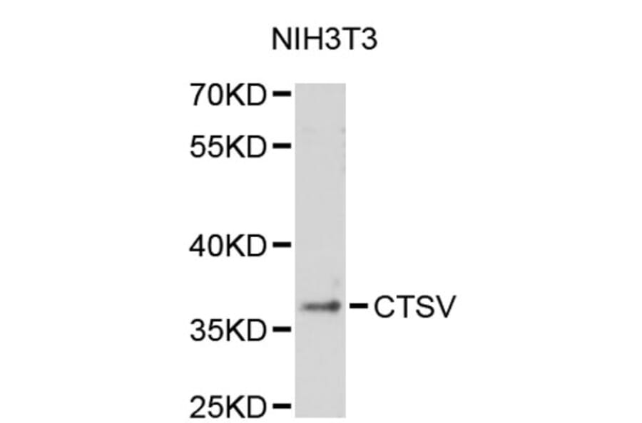 Western Blot - Anti-CTSV Antibody (A2680) - Antibodies.com