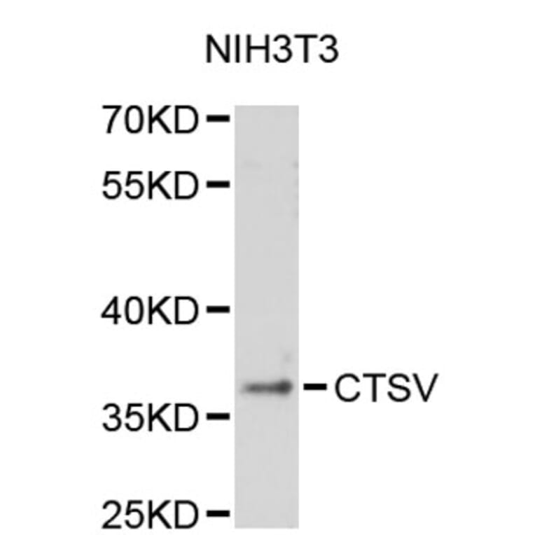 Western Blot - Anti-CTSV Antibody (A2680) - Antibodies.com