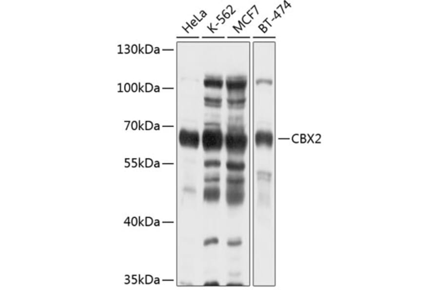 Western Blot - Anti-CBX2 Antibody (A2683) - Antibodies.com