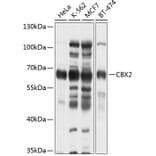 Western Blot - Anti-CBX2 Antibody (A2683) - Antibodies.com
