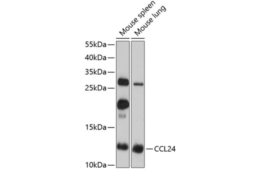 Western Blot - Anti-CCL24 Antibody (A2684) - Antibodies.com