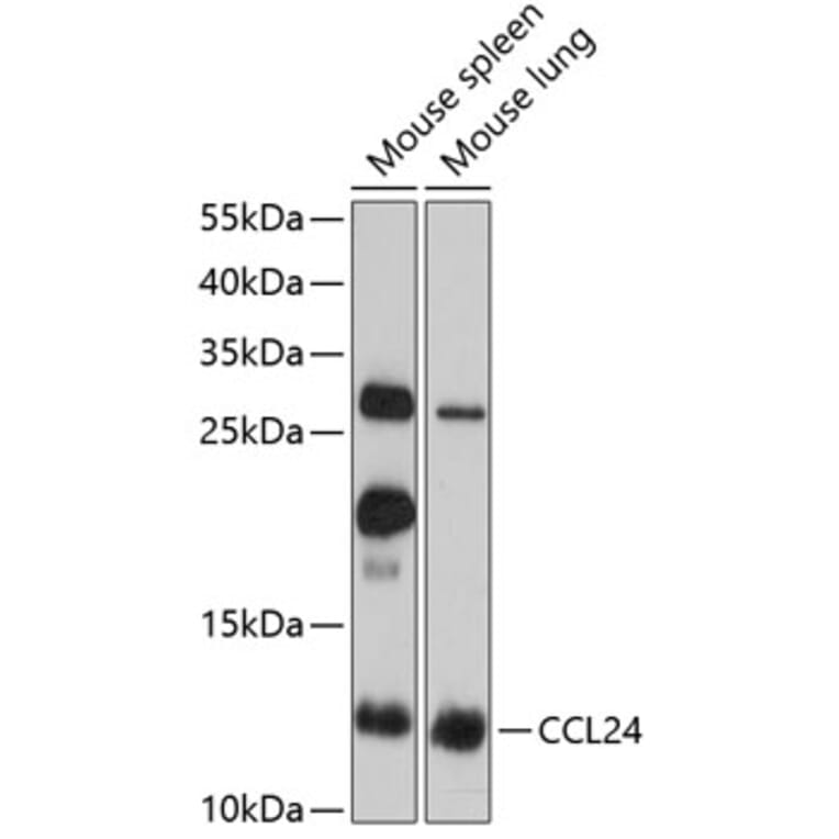 Western Blot - Anti-CCL24 Antibody (A2684) - Antibodies.com