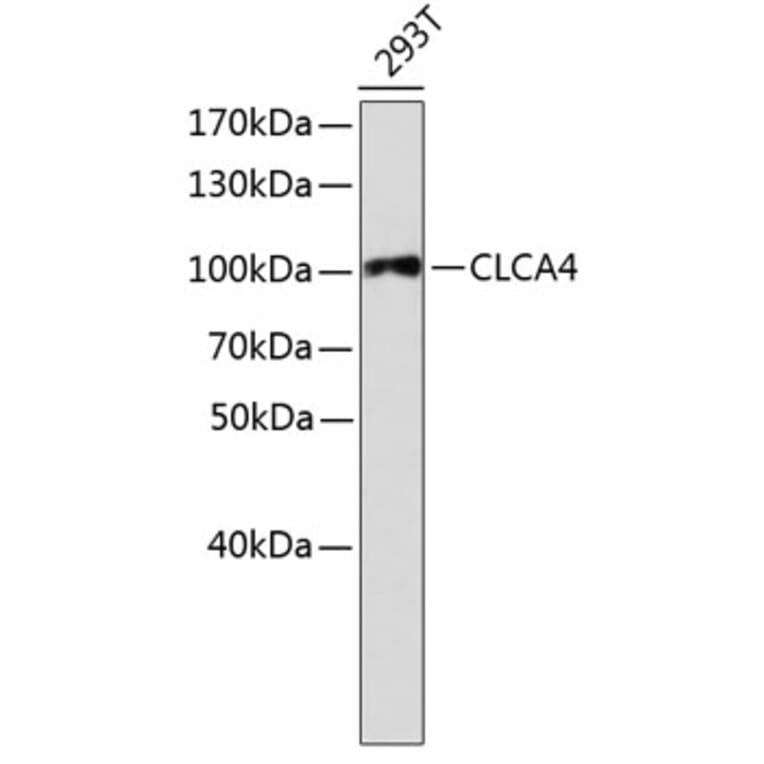 Western Blot - Anti-CLCA4 Antibody (A2695) - Antibodies.com