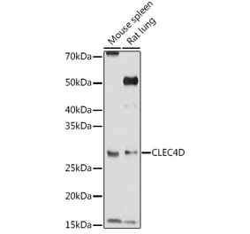 Western Blot - Anti-CLEC4D Antibody (A9074) - Antibodies.com