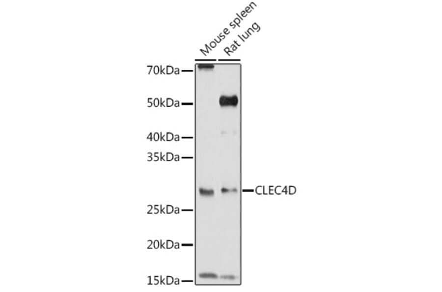 Western Blot - Anti-CLEC4D Antibody (A9074) - Antibodies.com