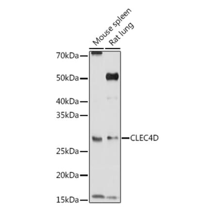 Western Blot - Anti-CLEC4D Antibody (A9074) - Antibodies.com