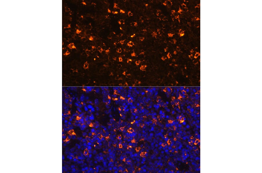 Immunofluorescence - Anti-CLEC4D Antibody (A9074) - Antibodies.com