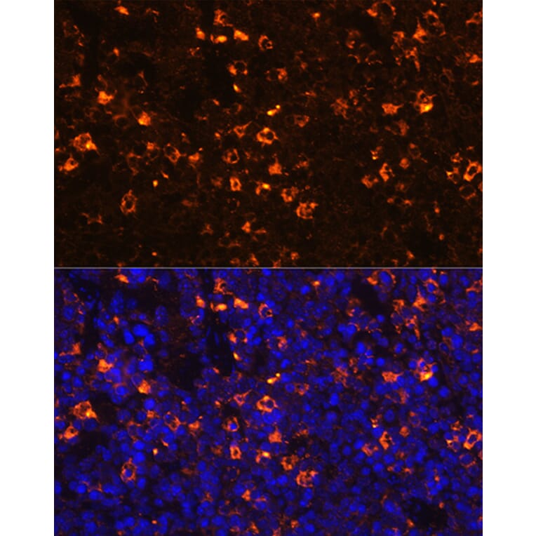 Immunofluorescence - Anti-CLEC4D Antibody (A9074) - Antibodies.com