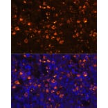 Immunofluorescence - Anti-CLEC4D Antibody (A9074) - Antibodies.com