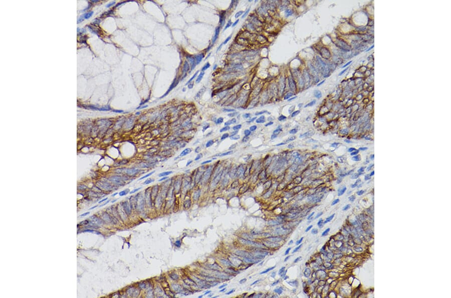 Immunohistochemistry - Anti-IL-18R1 Antibody (A9075) - Antibodies.com