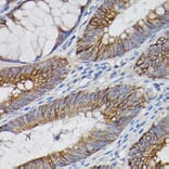 Immunohistochemistry - Anti-IL-18R1 Antibody (A9075) - Antibodies.com