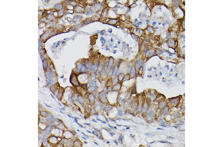 Immunohistochemistry - Anti-IL-18R1 Antibody (A9075) - Antibodies.com