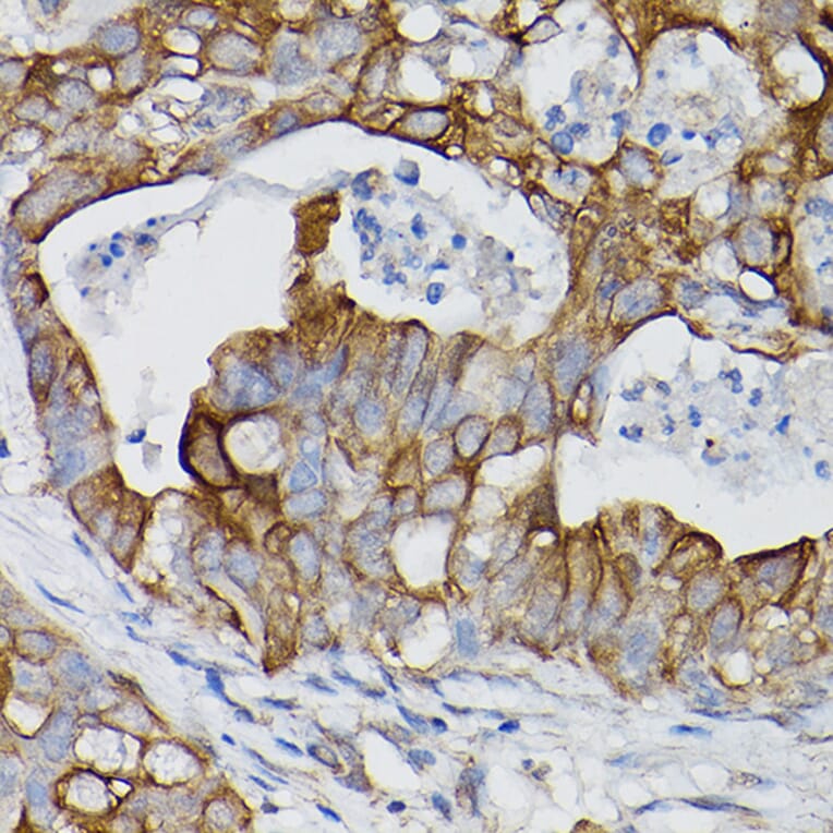 Immunohistochemistry - Anti-IL-18R1 Antibody (A9075) - Antibodies.com