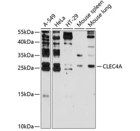 Western Blot - Anti-CLECSF6 Antibody (A9076) - Antibodies.com