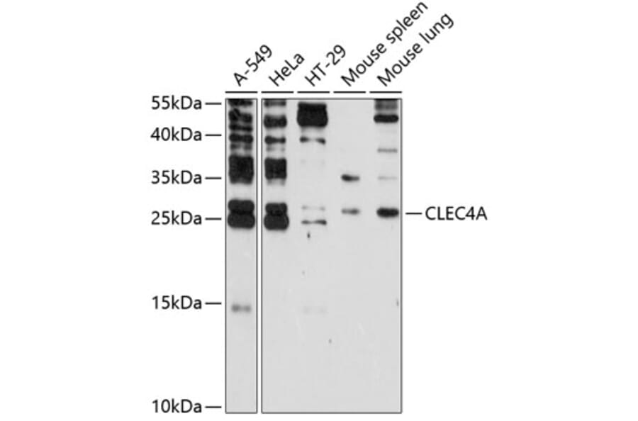Western Blot - Anti-CLECSF6 Antibody (A9076) - Antibodies.com