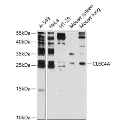 Western Blot - Anti-CLECSF6 Antibody (A9076) - Antibodies.com