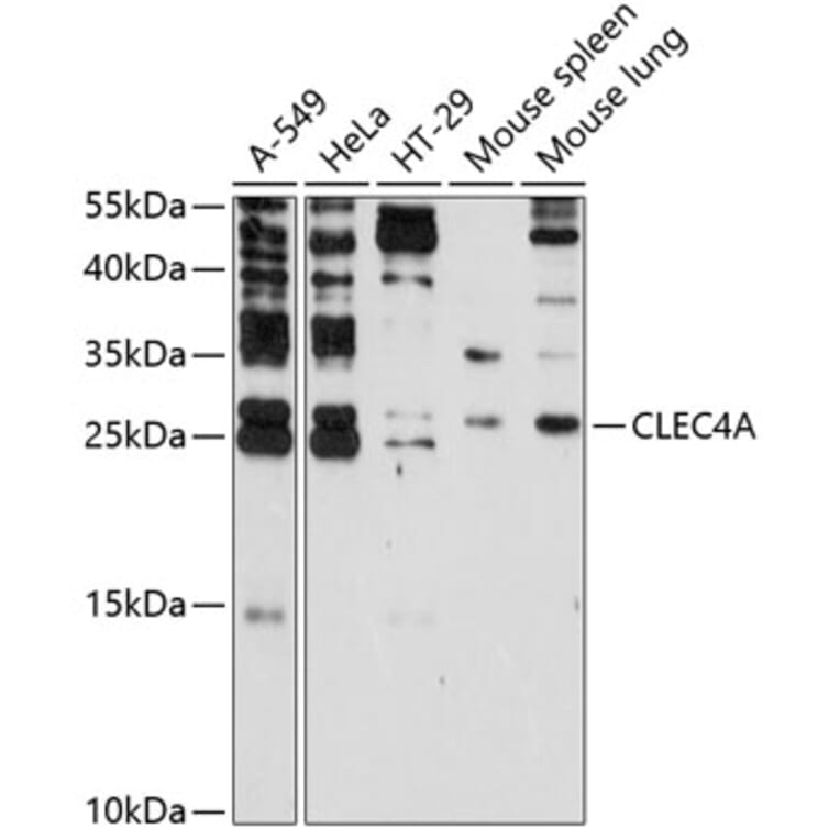 Western Blot - Anti-CLECSF6 Antibody (A9076) - Antibodies.com