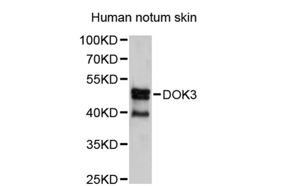 Western Blot - Anti-DOK3 Antibody (A2716) - Antibodies.com