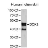 Western Blot - Anti-DOK3 Antibody (A2716) - Antibodies.com