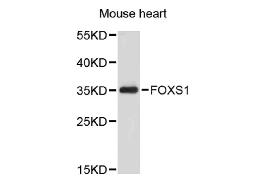 Western Blot - Anti-FOXS1 Antibody (A2730) - Antibodies.com