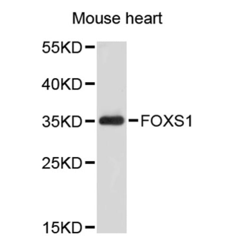 Western Blot - Anti-FOXS1 Antibody (A2730) - Antibodies.com