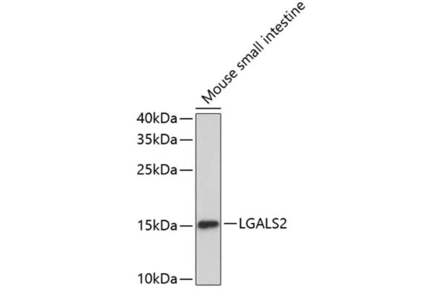 Western Blot - Anti-LGALS2 Antibody (A2734) - Antibodies.com