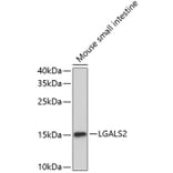 Western Blot - Anti-LGALS2 Antibody (A2734) - Antibodies.com