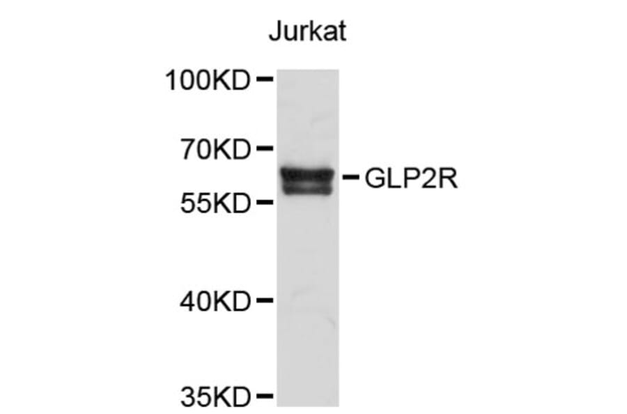 Western Blot - Anti-GLP2R Antibody (A2740) - Antibodies.com