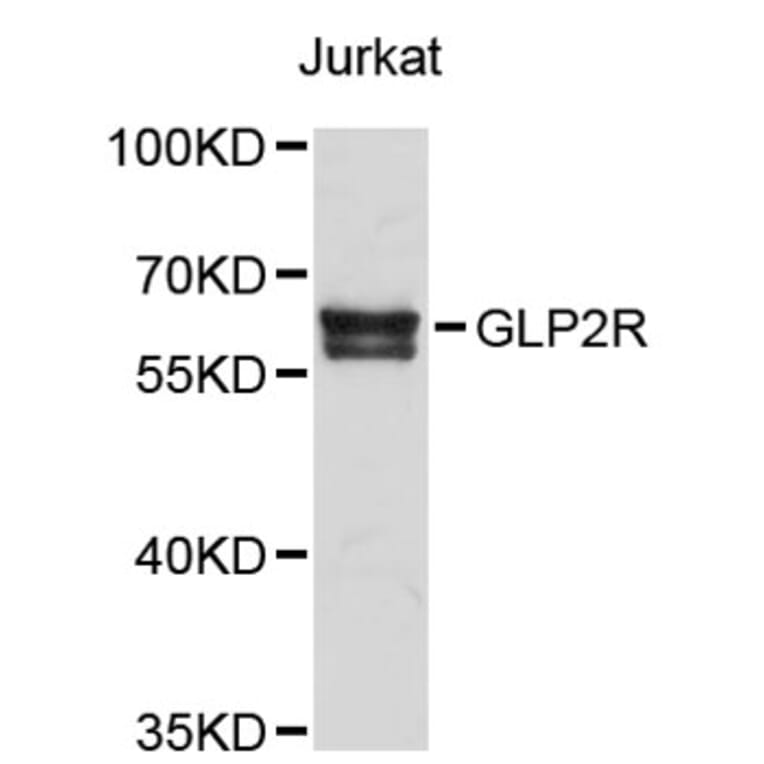 Western Blot - Anti-GLP2R Antibody (A2740) - Antibodies.com