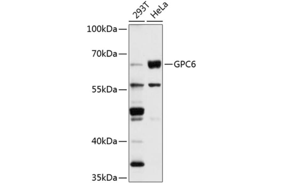 Western Blot - Anti-Glypican 6 Antibody (A9081) - Antibodies.com