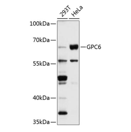 Western Blot - Anti-Glypican 6 Antibody (A9081) - Antibodies.com