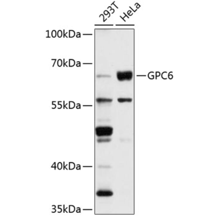 Western Blot - Anti-Glypican 6 Antibody (A9081) - Antibodies.com