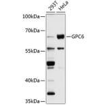 Western Blot - Anti-Glypican 6 Antibody (A9081) - Antibodies.com