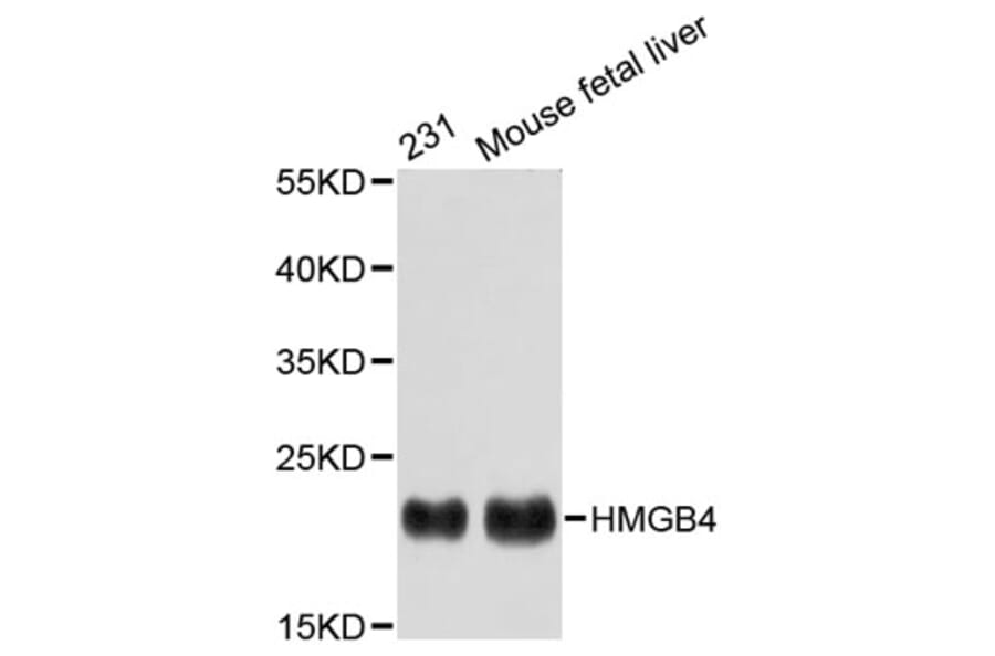 Western Blot - Anti-HMGB4 Antibody (A2744) - Antibodies.com