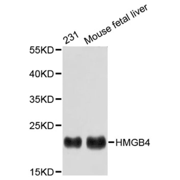 Western Blot - Anti-HMGB4 Antibody (A2744) - Antibodies.com