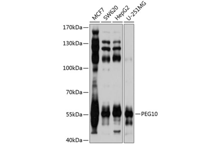 Western Blot - Anti-PEG10/EDR Antibody (A9086) - Antibodies.com