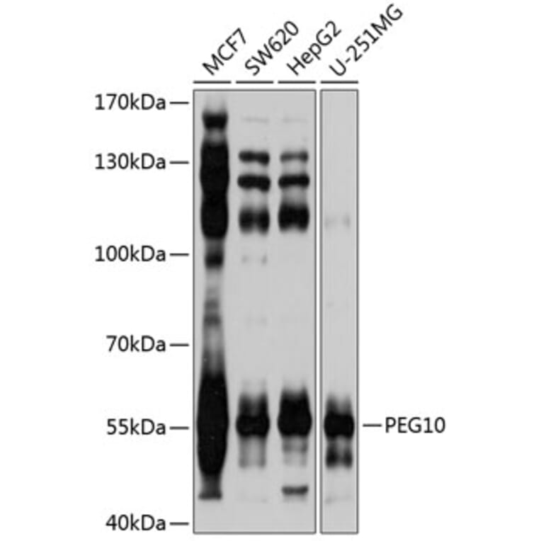 Western Blot - Anti-PEG10/EDR Antibody (A9086) - Antibodies.com