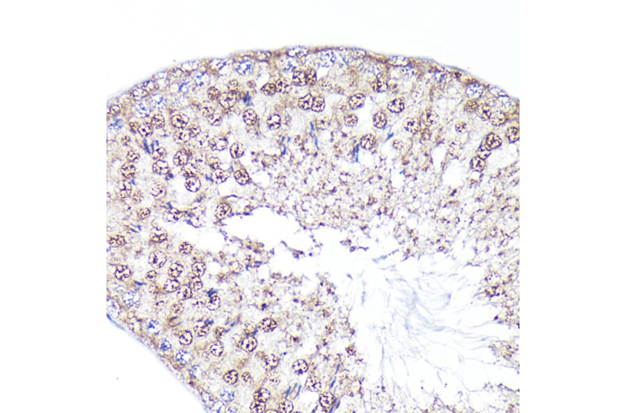 Immunohistochemistry - Anti-PEG10/EDR Antibody (A9086) - Antibodies.com