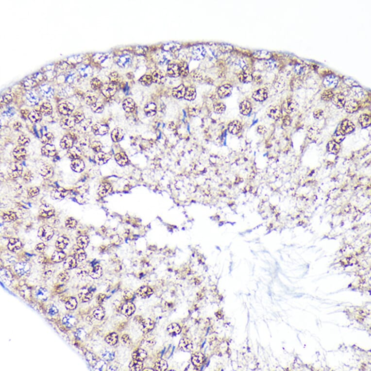 Immunohistochemistry - Anti-PEG10/EDR Antibody (A9086) - Antibodies.com