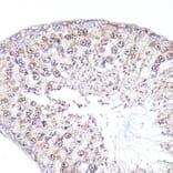 Immunohistochemistry - Anti-PEG10/EDR Antibody (A9086) - Antibodies.com