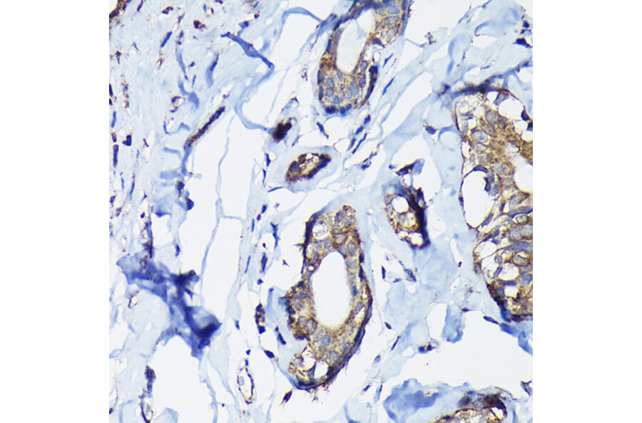 Immunohistochemistry - Anti-PEG10/EDR Antibody (A9086) - Antibodies.com