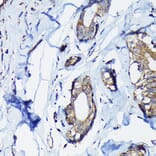 Immunohistochemistry - Anti-PEG10/EDR Antibody (A9086) - Antibodies.com