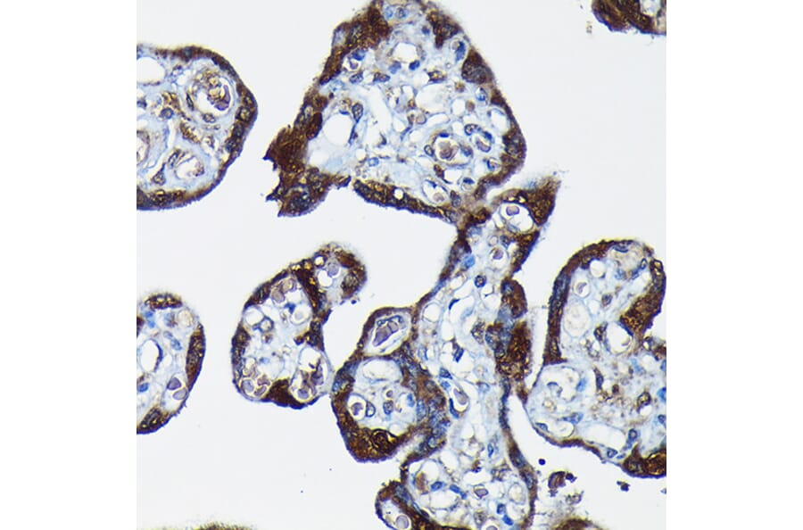 Immunohistochemistry - Anti-PEG10/EDR Antibody (A9086) - Antibodies.com