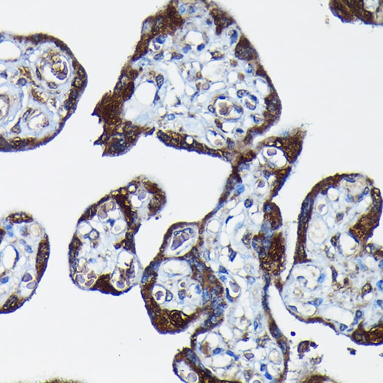 Immunohistochemistry - Anti-PEG10/EDR Antibody (A9086) - Antibodies.com
