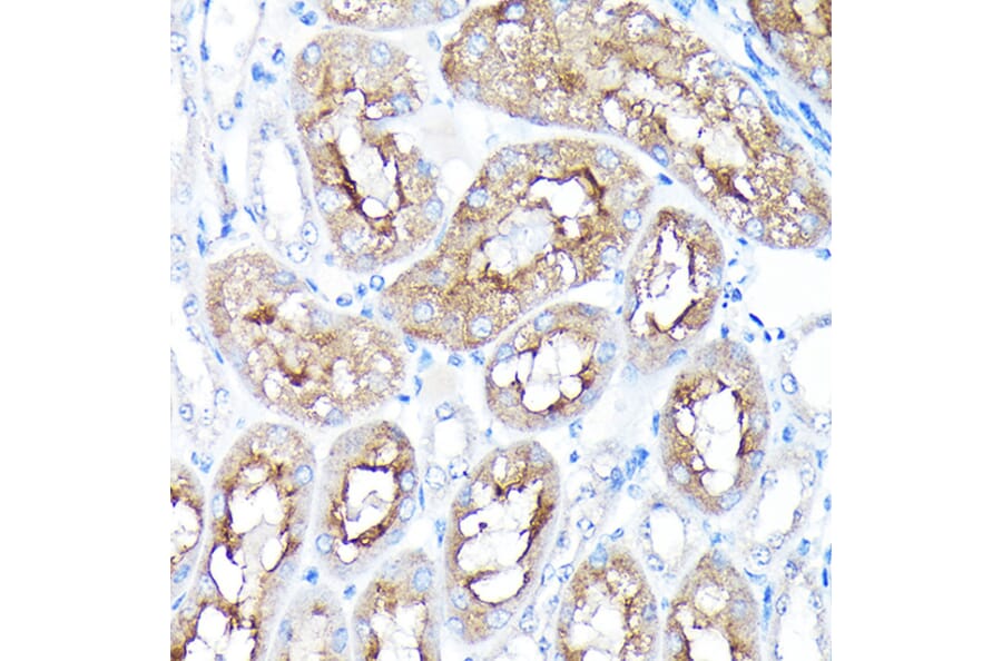 Immunohistochemistry - Anti-PEG10/EDR Antibody (A9086) - Antibodies.com