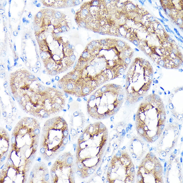 Immunohistochemistry - Anti-PEG10/EDR Antibody (A9086) - Antibodies.com